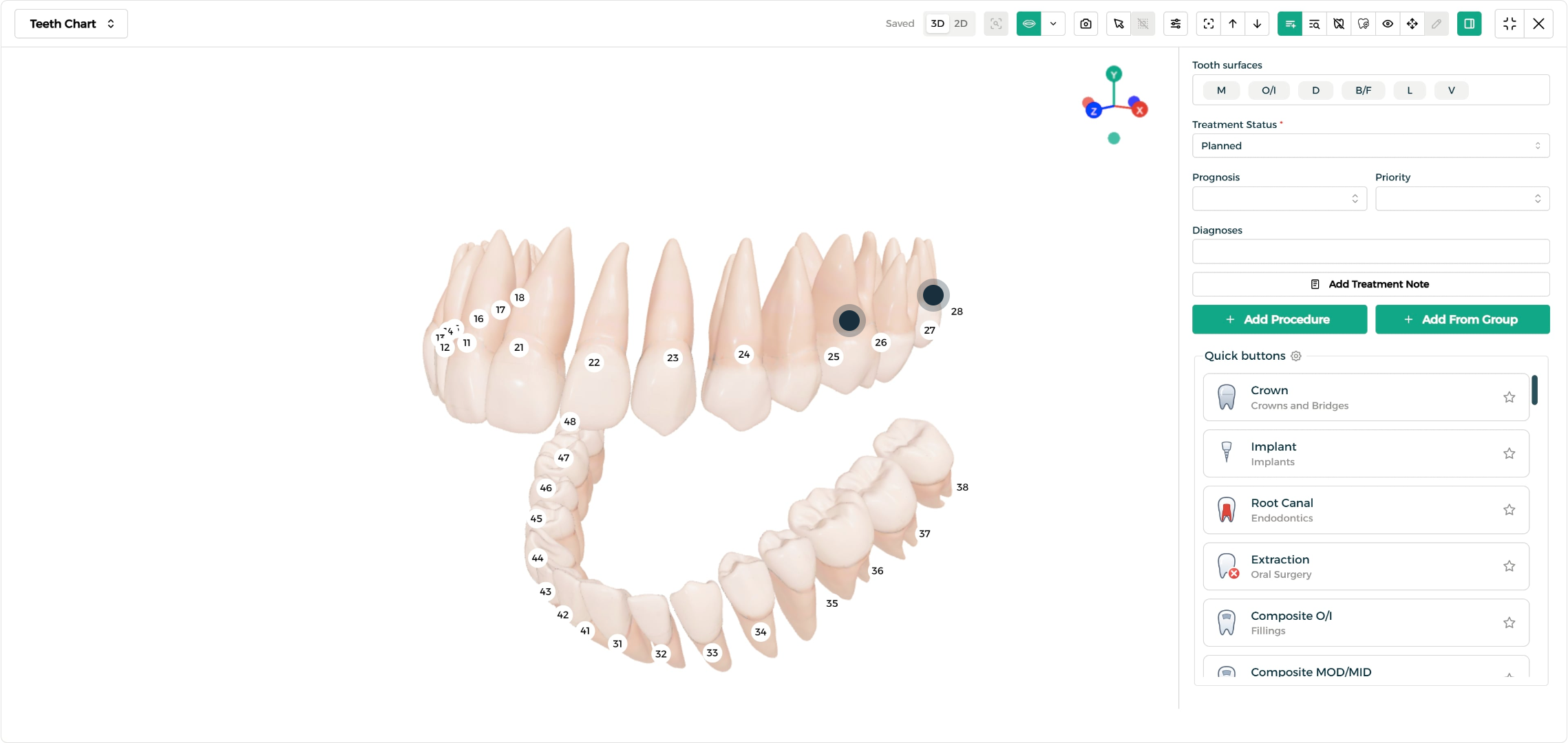 Step 2 - Select a tooth